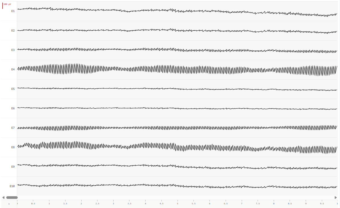 Bodha multi-channel EEG waveform